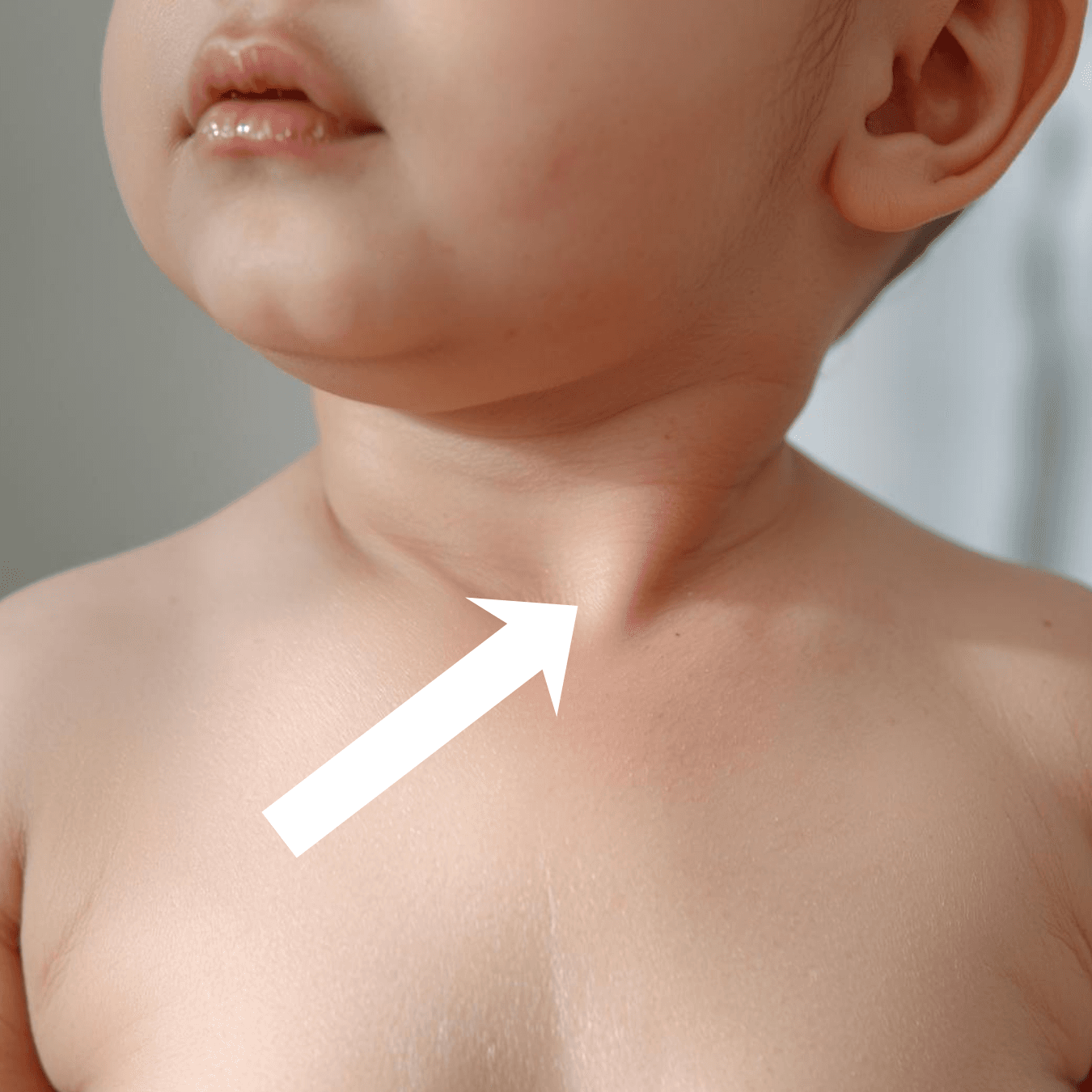 5 mythes sur le torticolis du bébé